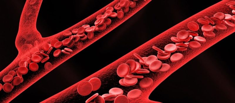 Atardamar Hastalıkları