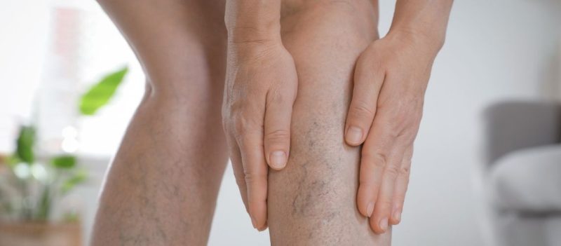 Toplardamar Hastalıkları